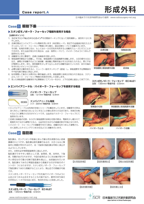 【形成外科】Case report AB　形成外科症例紹介