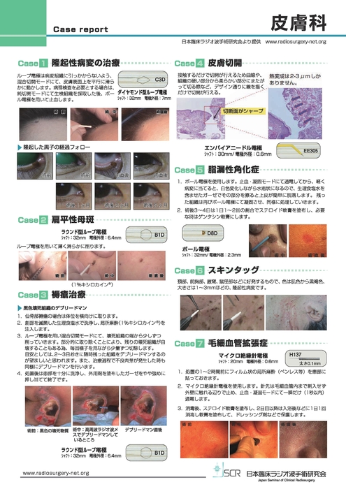 【皮膚科】Case report A　皮膚科症例紹介