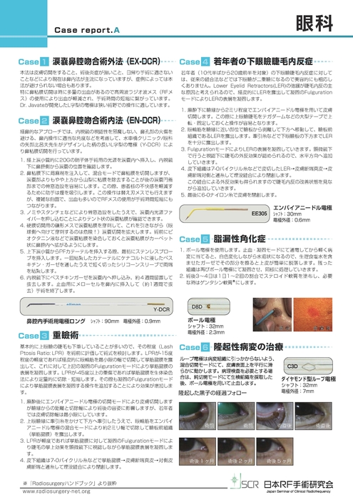 【眼科】Case report AB　眼科症例紹介