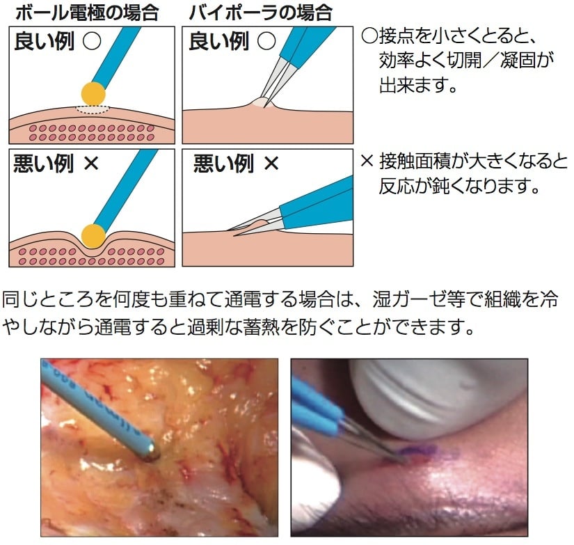 獣医科での貸出について 切開・凝固のコツ