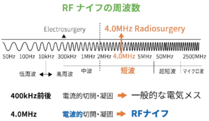 RFナイフの周波数