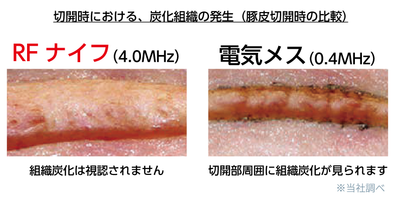 RFナイフの特徴③　組織炭化の少なさ(SSI予防)