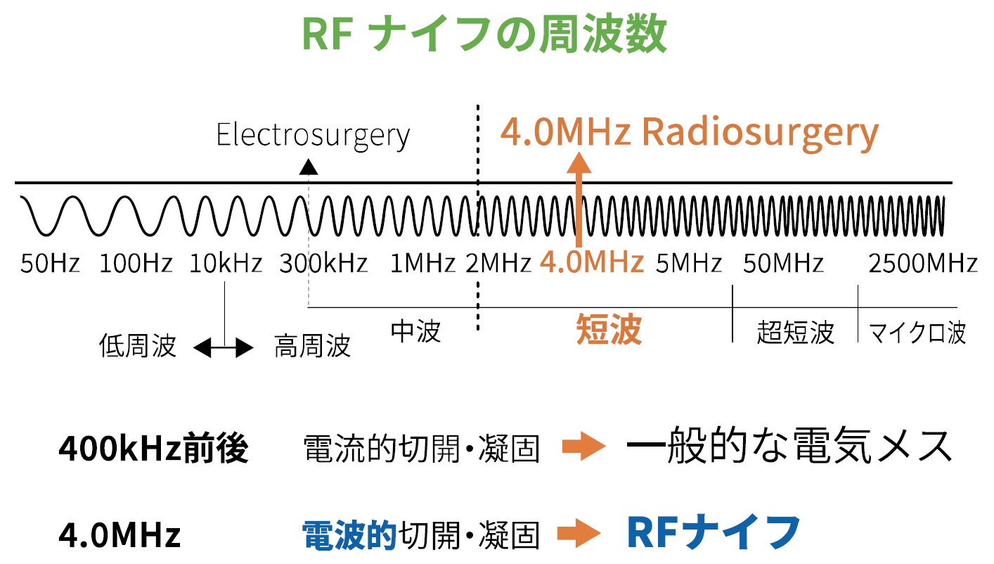RFナイフの特徴①　4.0MHzの周波数