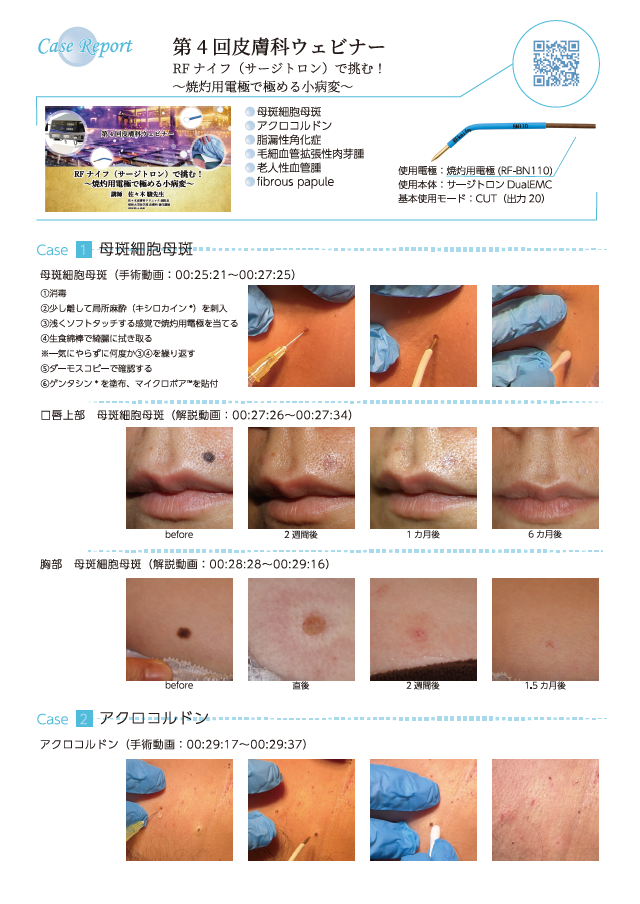 【皮膚科】Case report 第4回皮膚科ウェビナー