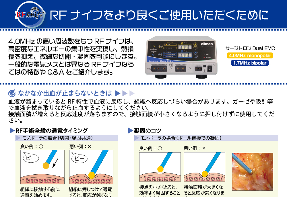 RFナイフをより良くご使用いただくために